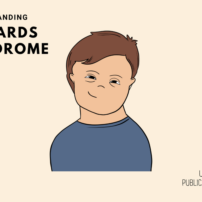 Understanding Edwards Syndrome