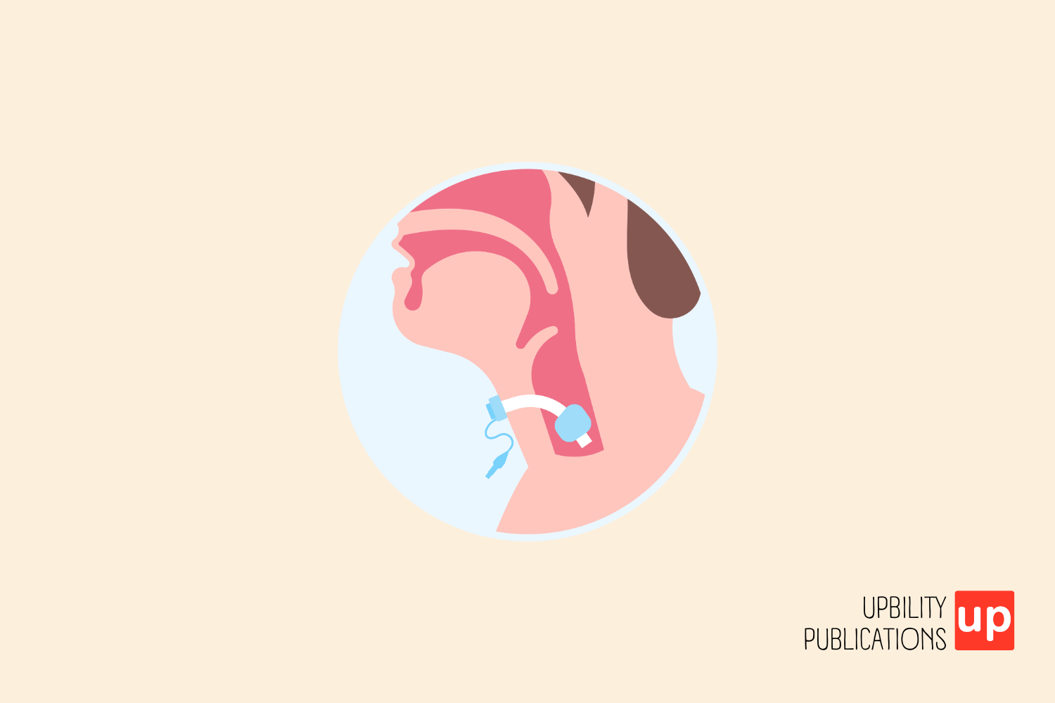 Effective Tracheostomy Speech Therapy Goals for Improved Communication